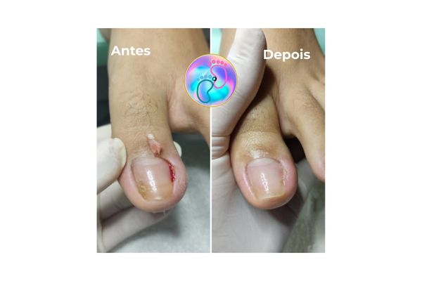 Foto de antes e depois do tratamento 26